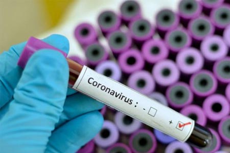 361 new cases of coronavirus infection detected in Armenia over the  past day