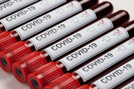 138 new cases of coronavirus infection detected in Armenia over the  past day