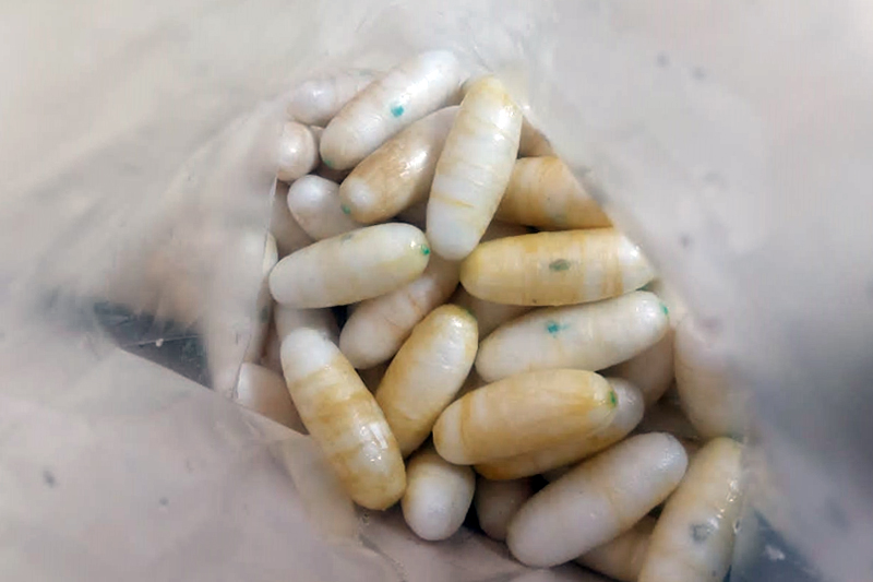 Армянские таможенники обнаружили в желудке гражданина Бразилии 1216 граммов кокаина на сумму в $300 тысяч