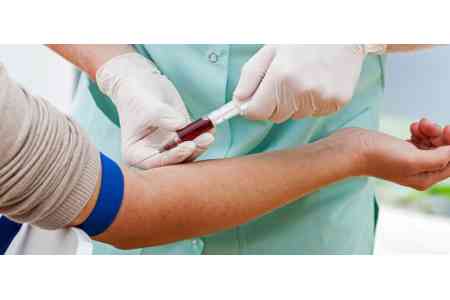 В Армении все медработники, маникюрщики, педикюрщики, косметологи и специалисты тату будут проверятся на наличие вирусных гепатитов В и С
