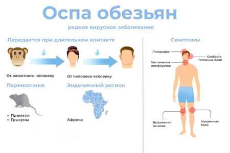 Риск проникновения и распространения в Армении оспы обезьян считается низким - Минздрав РА